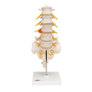 [3B] 요추모형 A76/5 (34cm/0.74kg) Lumbar Spinal Column with Dorso
