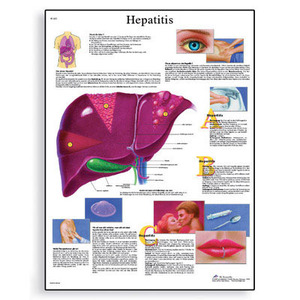 [3B] 간염차트 VR1435L(코팅)/VR1435UU(비코팅) Hepatitis Chart /50 x 67 cm